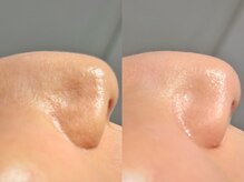 ルーナジェーナ(Luna llena)/池袋　エステ　ルーナジェーナ