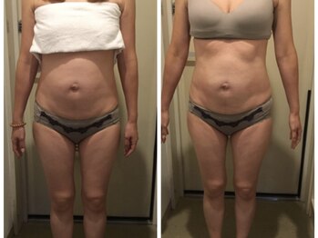 ブルーコーラル エム(BLUE CORAL M)/全身リンパマッサージ 90