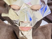 リノ(Lino)の雰囲気（光フェイシャル＋パックでシミくすみ改善&リフトUP◎）