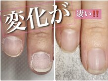 スターネイル(Starnail)/半年の軌跡