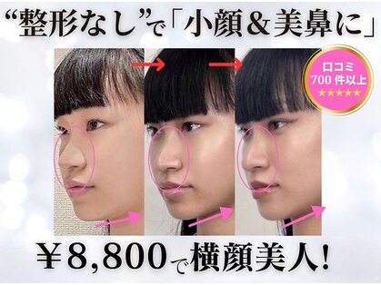 隆鼻矯正専門店 ラプリ(Raplit)の写真