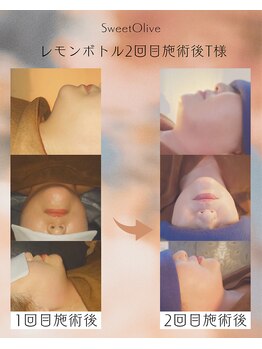 スウィートオリーブ 春日部(SweetOlive)/レモンボトルの効果