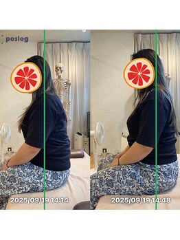 グレフル鍼灸接骨院 整体院 心斎橋/整体/肩こり/マッサージ/腰痛