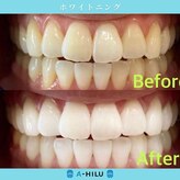 アーヒル 富山店(A”-HILU)