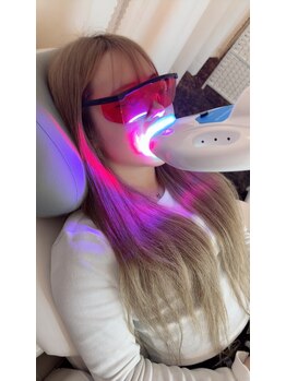 ペルラメディカルホワイトニング 名古屋/衝撃の変化　自分史上最白