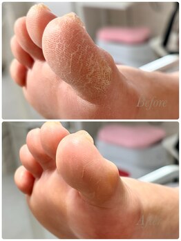 ソワン(soin)/Before→After