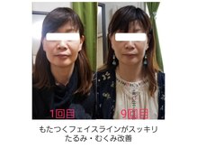 りんぱサロン まり