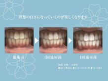 ホワイトニング ハナ 南本町店(WHITENING HANA)/お好みの白さへ！