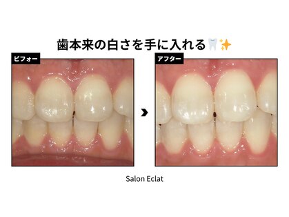 サロン エクラ(Salon E'clat)の写真