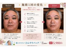 レヴォーテ 練馬(Re-Beaute)/こんなに小顔に、、、