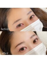 ダリ(Dali)/ハリウッドブロウリフト