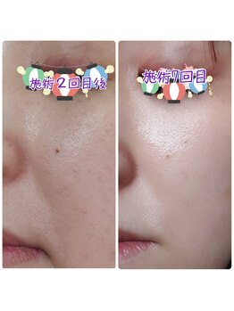 ルリアン(Le lien)/before after