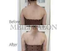 メイリー(MEILI)/温活高周波コース