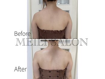 メイリー(MEILI)/温活高周波コース