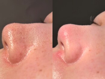 ルーナジェーナ(Luna llena)/池袋 エステ ルーナジェーナ