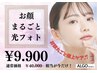 【ワンランク上の肌質改善】即日実感♪光フォト体験☆￥9900