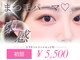 ウィンク(WINK)の写真