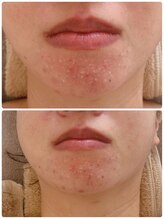 スリムアンドビューティー メゾン ド シュシュ(Slim&Beauty Maison de chouchou)/韓国NO1ララピール