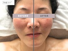 ビューティー ブロッサム(Beauty Blossom)/