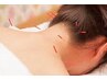【眼精疲労や深いコリ】鍼灸クーポン 鍼施術60分¥7700⇒¥3,980円(税込)
