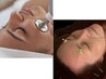 【フェイスライン＆頬のたるみ緩和】美容鍼＆インディバ 70分13500円→8800円