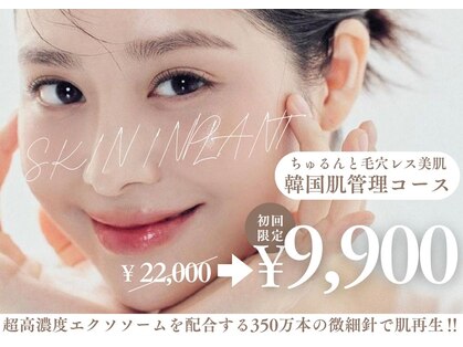 ヨウキ(YOKI)の写真