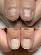 マリーロール 淀屋橋本店(Marie Laure)/自爪育成/深爪矯正/ネイルケア