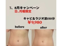 カオク ビューティーサロン(kaoku beauty salon)の雰囲気（日・月限定キャンペーン　気になる脂肪・むくみに）