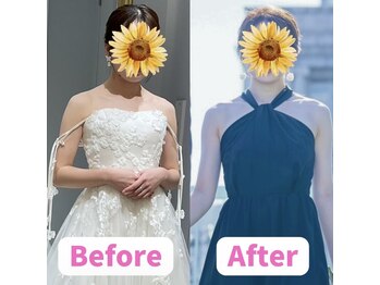 ボディキュア ブライダル美容整体 大阪梅田/鎖骨のお悩みを解決！/大阪西口