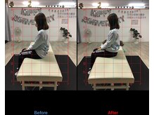 ストレチックス 近江八幡店/姿勢改善ビフォーアフター1回