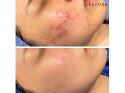 シーベル 新宿の写真