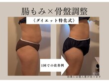 シュシュ 岸和田(chouchou)/施術例/腸もみ×骨盤調整
