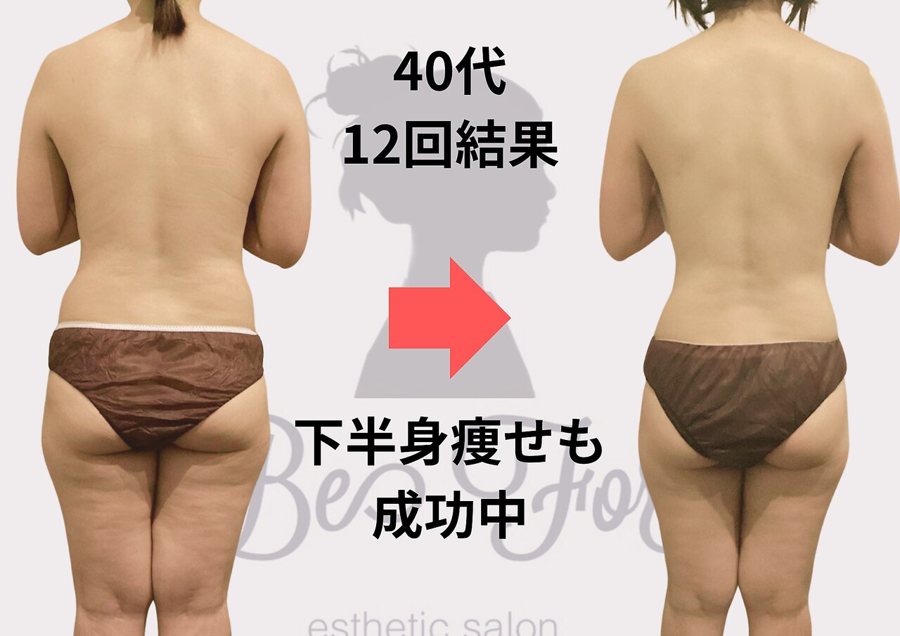 茨木市でキャビテーションが人気のエステサロン｜ホットペッパー