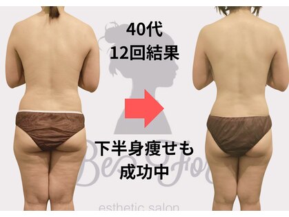 ビーフォー(be for)の写真