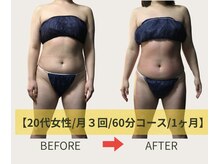 ネオボディ(Neo Body)/施術3回目