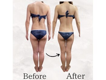 レナータ バイ アフロスクィーン(Renata by Aphros Queen)/Before&After