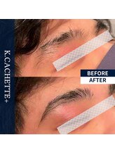 ケードット カシェットプラス(K.CACHETTE+)/アイブロウ　ビフォーアフター