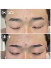 ボンドストーリー 名駅西口店(Bond Story)/ストレートアーチ