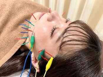 ことほぎ鍼灸整体 奈良登美ヶ丘院/リフトアップ美容鍼◎施術風景