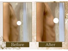 マリン(MARINE)/Before→After