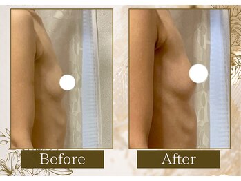 マリン(MARINE)/Before→After