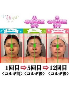 小顔整体研究所 KSラボ 新潟中山店/