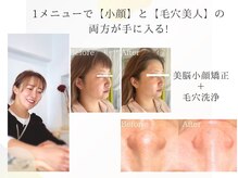 くすくす/美脳小顔矯正＋毛穴洗浄も人気！