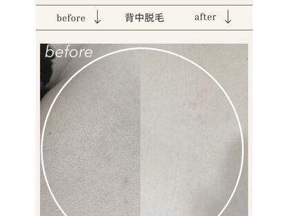 テテアテテ(tete a tete)の写真