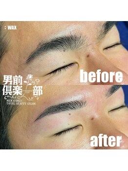 男前倶楽部/脱毛/メンズ脱毛/メンズ専門店