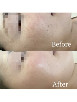 サロンディア(SALON Dea)/施術効果