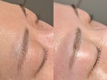 ルーナジェーナ(Luna llena)/池袋 エステ ルーナジェーナ