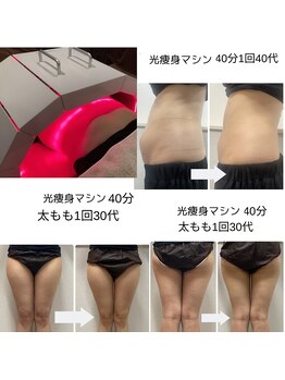 ラブニール 横浜店/メタケアでセルケア