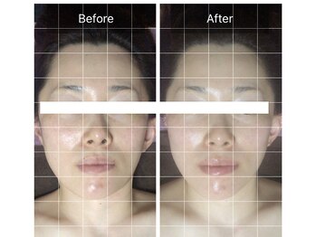 シーエスケイサロン(CSK salon)/艶肌フェイシャル