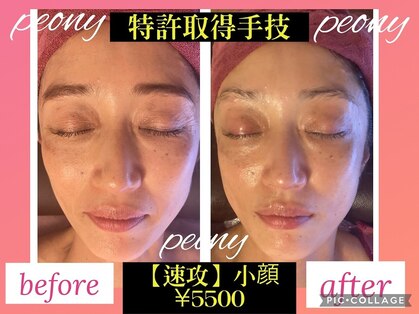 ピオニー(PEONY)の写真